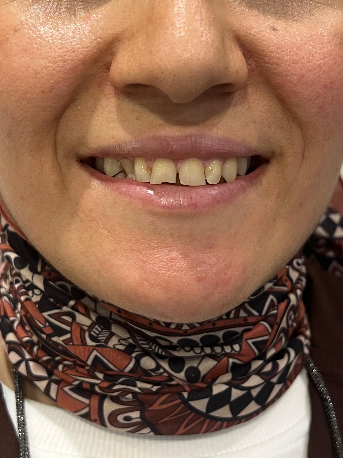 ECE Dental Patient Transformation